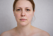 Bolile de ficat și tiroidă se pot reflecta pe chip: semnele timpurii la care trebuie să fii atentă