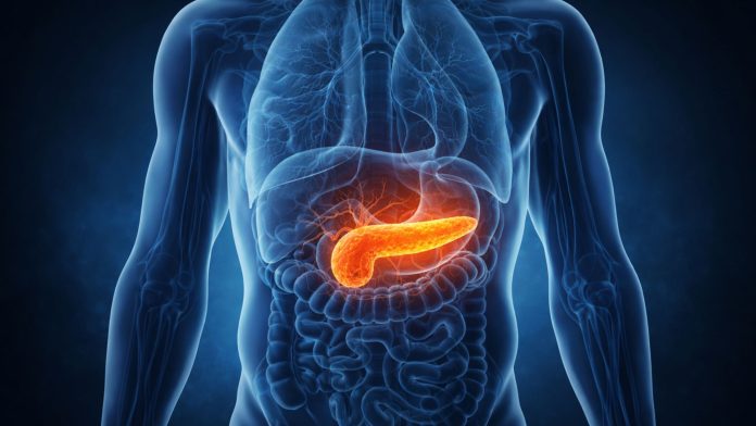 ilustrație medicală pancreas evidențiat în abdomen cu simptome asociate
