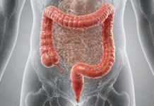 Semnele timpurii ale cancerului de colon pe care mulți le ignoră. Ce îți transmite corpul înainte să fie prea târziu Semne timpurii ale cancerului de colon