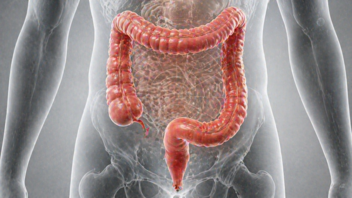 Semne timpurii ale cancerului de colon