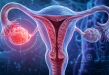 Ilustrație medicală realistă a sistemului reproducător feminin evidențiind ovarele