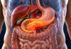 Cancerul pancreatic poate evolua în tăcere. 7 semne pe care mulți le ignoră până când boala este descoperită Ilustrație medicală a pancreasului și semne care pot apărea în cancerul pancreatic
