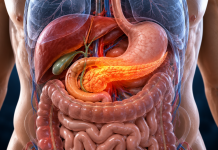 Cancerul pancreatic poate evolua în tăcere. 7 semne pe care mulți le ignoră până când boala este descoperită Ilustrație medicală a pancreasului și semne care pot apărea în cancerul pancreatic